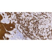 Cytokeratin 5 (58 kDa)